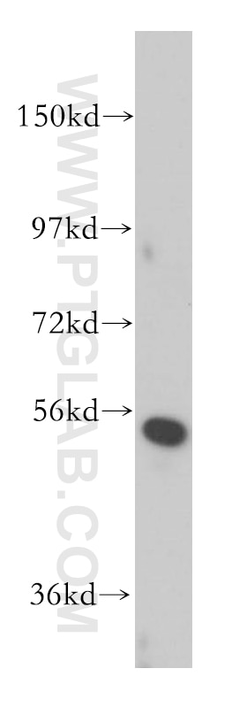 Western Blot (WB) analysis of Jurkat cells using CORO2B Polyclonal antibody (13802-1-AP)