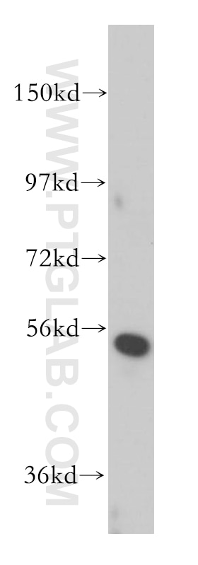 WB analysis of Jurkat using 13802-1-AP