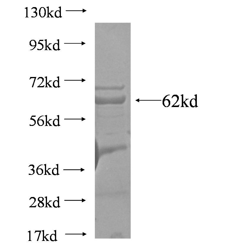 CORO2B fusion protein Ag4793 SDS-PAGE