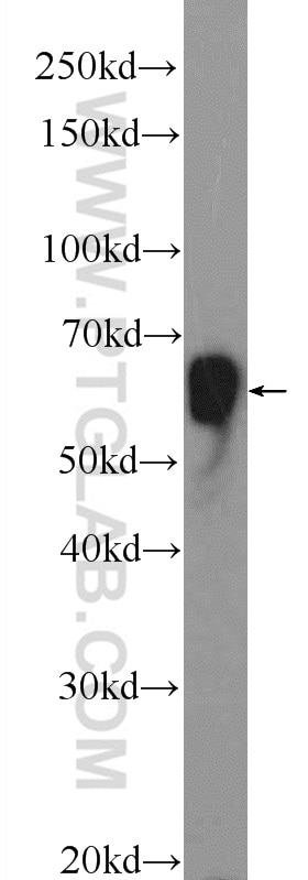 Western Blot (WB) analysis of mouse brain tissue using CORO6 Polyclonal antibody (17243-1-AP)