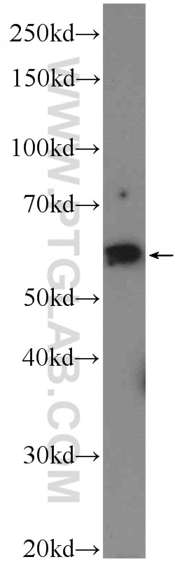 Western Blot (WB) analysis of rat skeletal muscle tissue using CORO6 Polyclonal antibody (17243-1-AP)