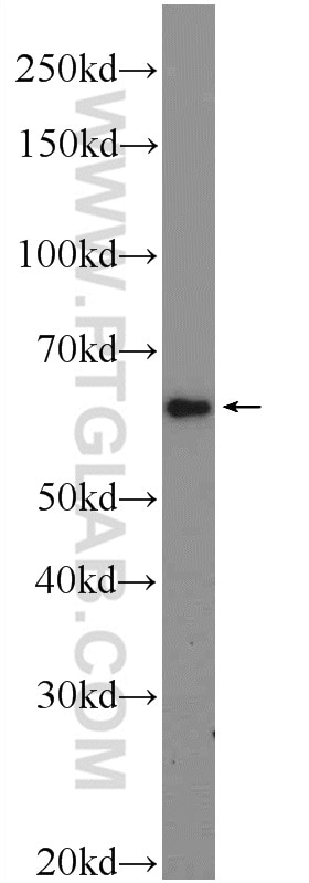 Western Blot (WB) analysis of mouse skeletal muscle tissue using CORO6 Polyclonal antibody (17243-1-AP)