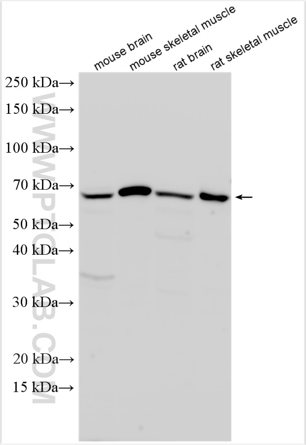 Western Blot (WB) analysis of various lysates using CORO6 Polyclonal antibody (17243-1-AP)