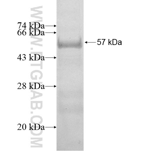CORO6 fusion protein Ag11167 SDS-PAGE