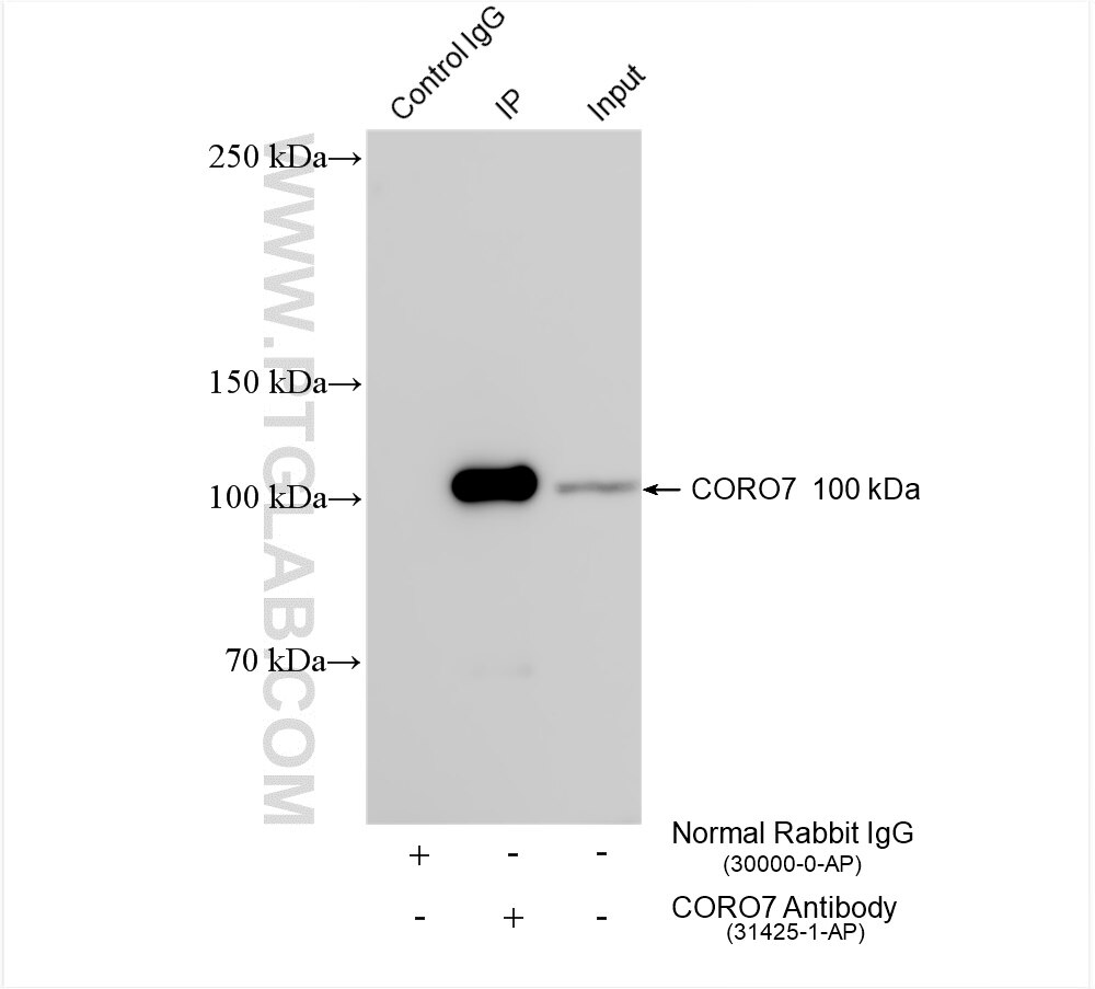 Immunoprecipitation (IP) experiment of HeLa cells using CORO7 Polyclonal antibody (31425-1-AP)