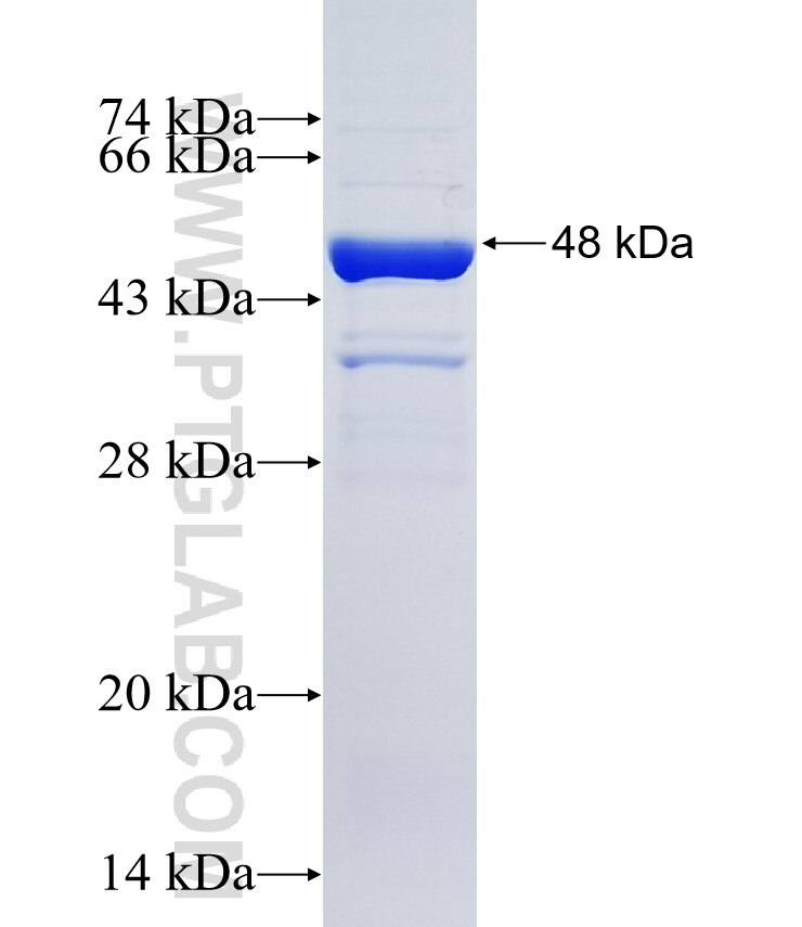CORO7 fusion protein Ag35016 SDS-PAGE
