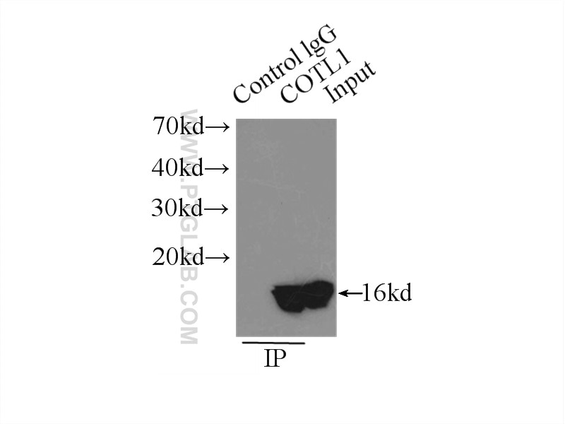Immunoprecipitation (IP) experiment of mouse kidney tissue using COTL1 Polyclonal antibody (10781-1-AP)