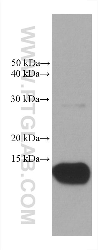 Western Blot (WB) analysis of human peripheral blood platelets using COTL1 Monoclonal antibody (60237-1-Ig)