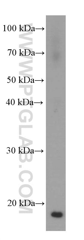 WB analysis of fetal human brain using 60237-1-Ig