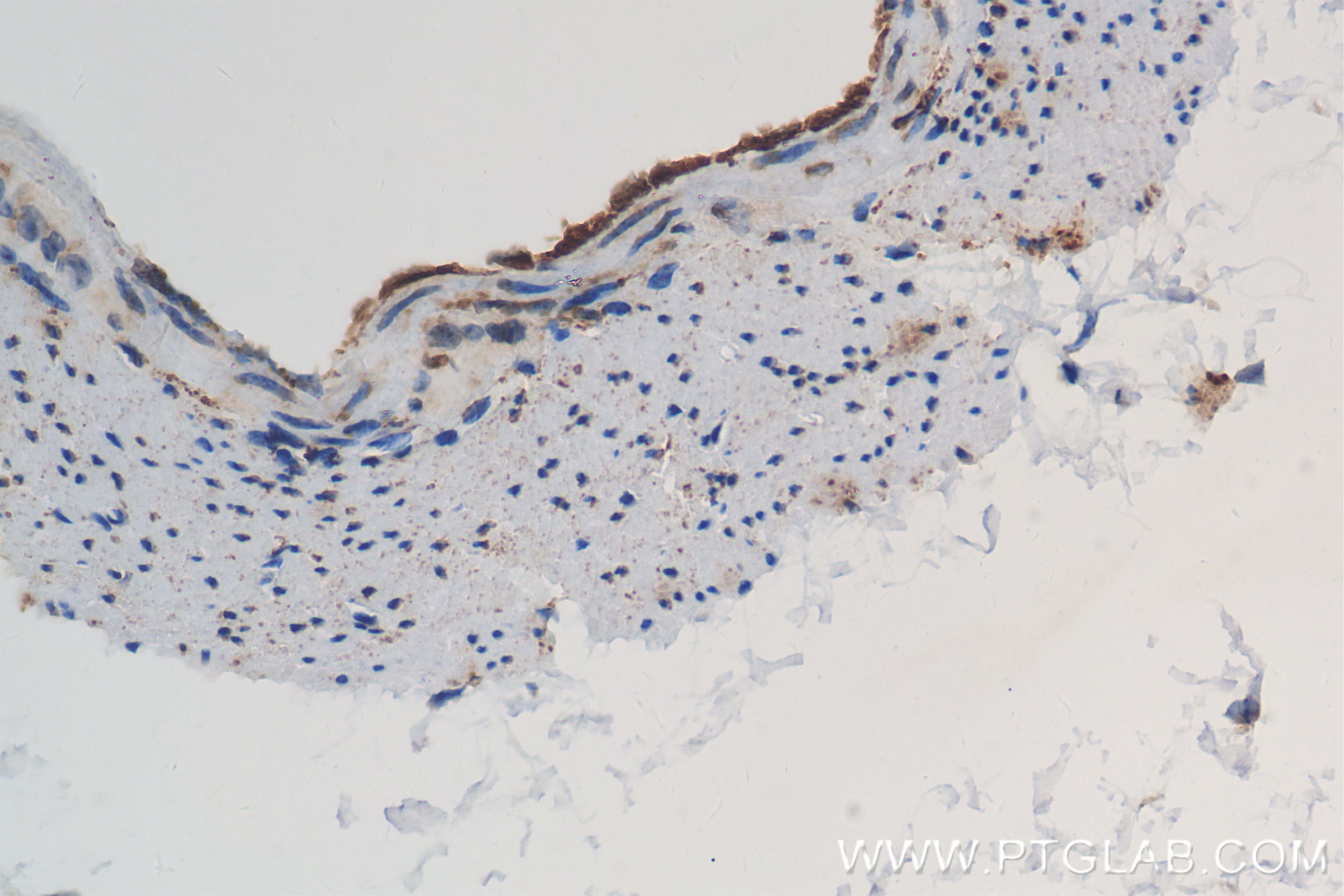 Immunohistochemistry (IHC) staining of mouse stomach tissue using COX-1/Cyclooxygenase-1 Recombinant antibody (84151-4-RR)