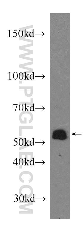 Western Blot (WB) analysis of A549 cells using COX10 Polyclonal antibody (10611-2-AP)