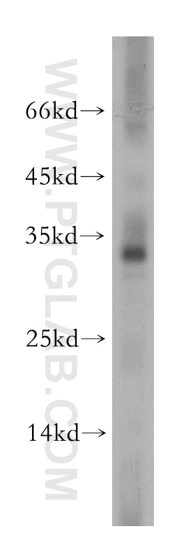 Western Blot (WB) analysis of mouse brain tissue using COX11 Polyclonal antibody (11498-1-AP)