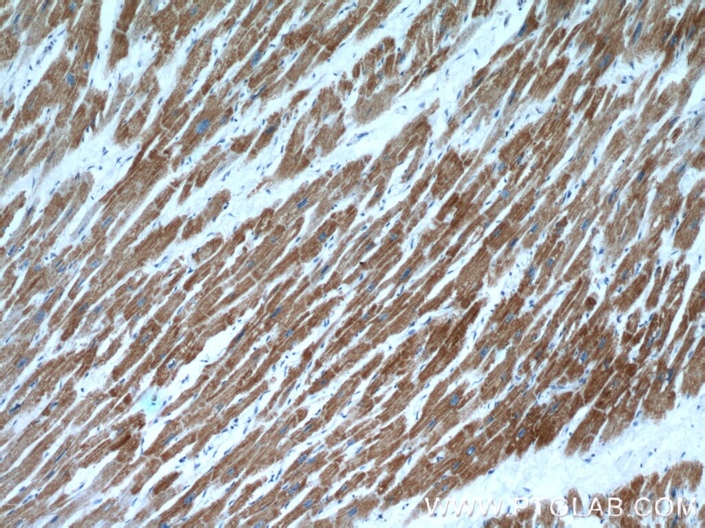 Immunohistochemistry (IHC) staining of human heart tissue using COX15 Polyclonal antibody (11441-1-AP)