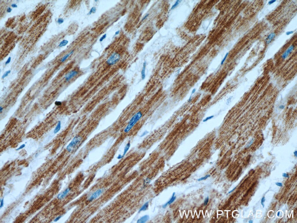 Immunohistochemistry (IHC) staining of human heart tissue using COX15 Polyclonal antibody (11441-1-AP)