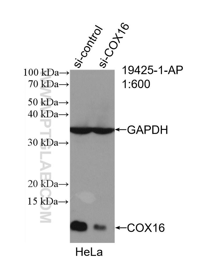 Western Blot (WB) analysis of HeLa cells using COX16 Polyclonal antibody (19425-1-AP)