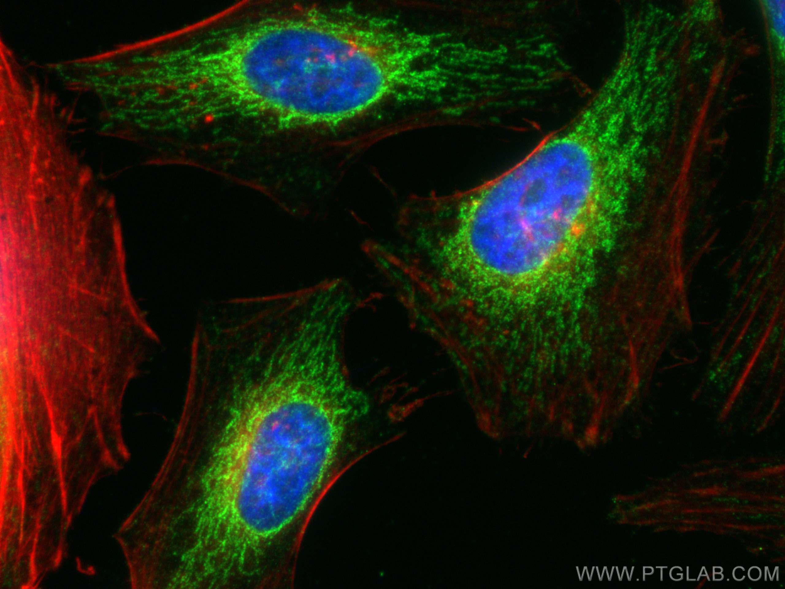 Immunofluorescence (IF) / fluorescent staining of HeLa cells using COX17 Polyclonal antibody (11464-1-AP)