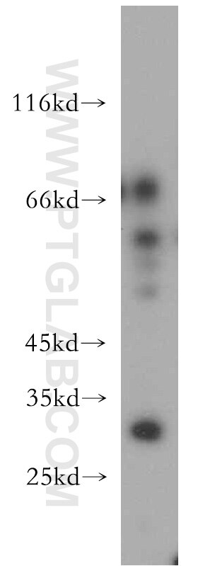 Western Blot (WB) analysis of NIH/3T3 cells using COX18 Polyclonal antibody (18071-1-AP)