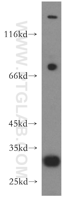 Western Blot (WB) analysis of HeLa cells using COX18 Polyclonal antibody (18071-1-AP)