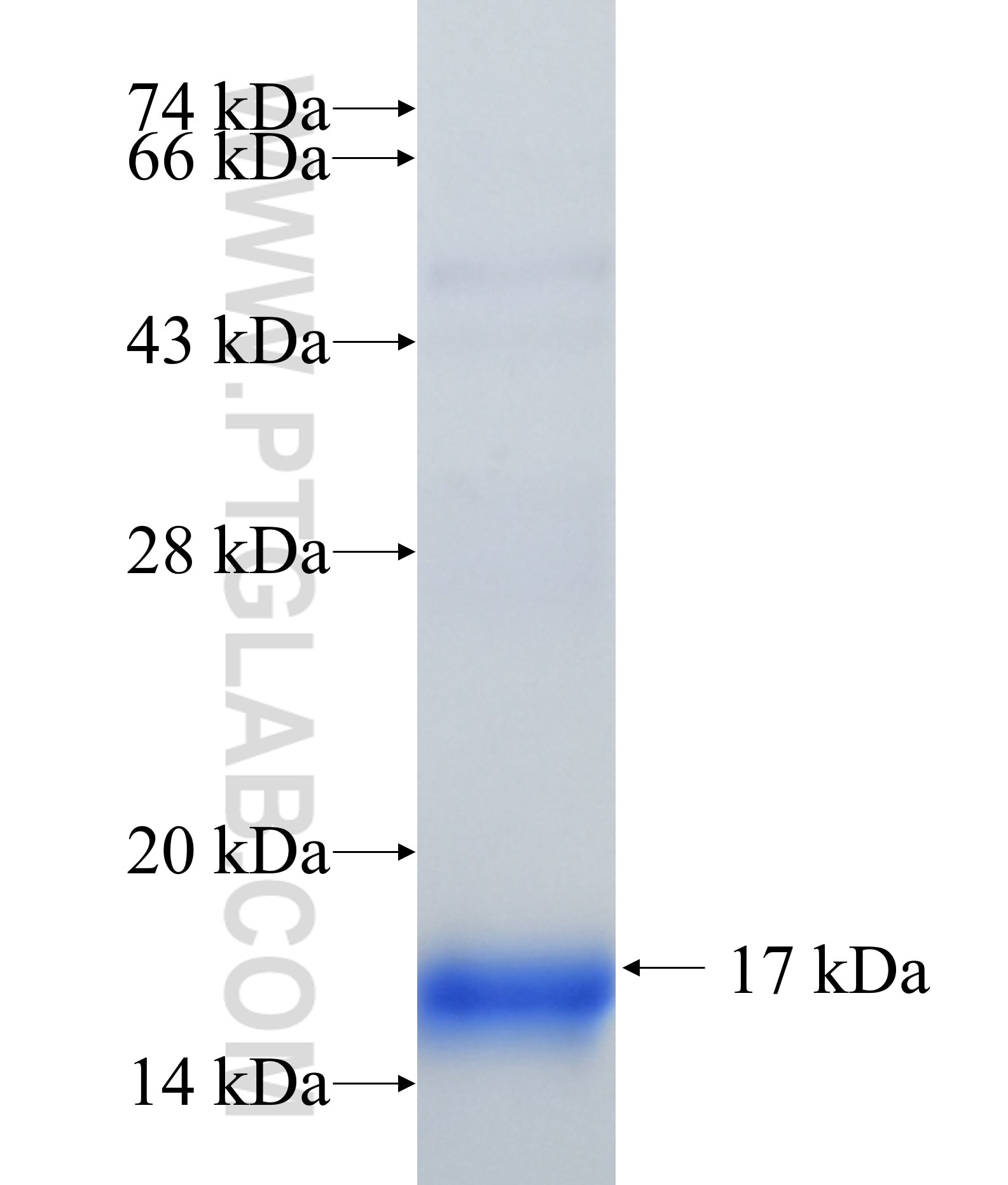 COX19 fusion protein Ag35103 SDS-PAGE COX19 fusion protein Ag35103 SDS-PAGE