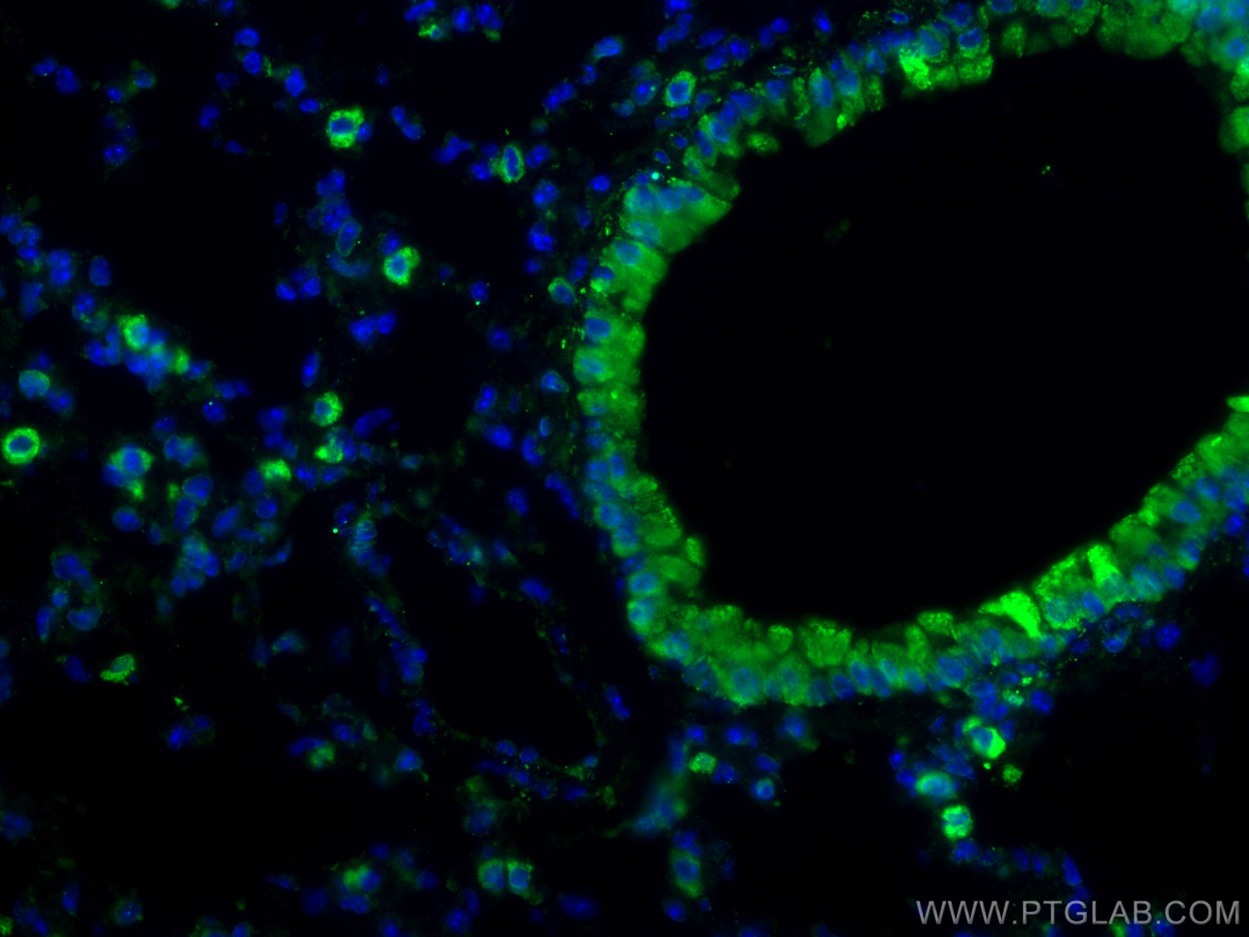 Immunofluorescence (IF) / fluorescent staining of mouse lung tissue using COX2/ Cyclooxygenase 2/ PTGS2 Polyclonal antibody (27308-1-AP)