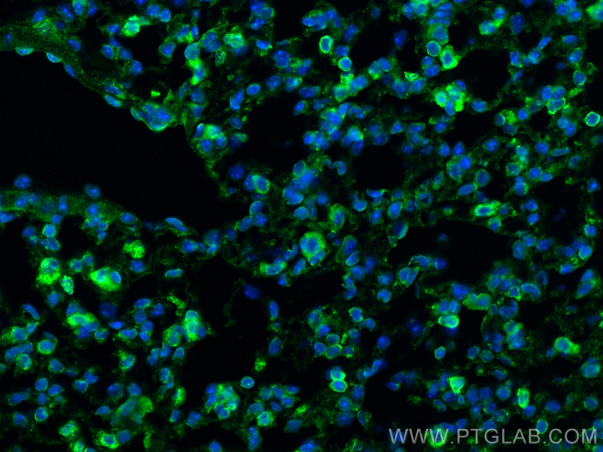Immunofluorescence (IF) / fluorescent staining of mouse lung tissue using COX2/ Cyclooxygenase 2/ PTGS2 Polyclonal antibody (27308-1-AP)
