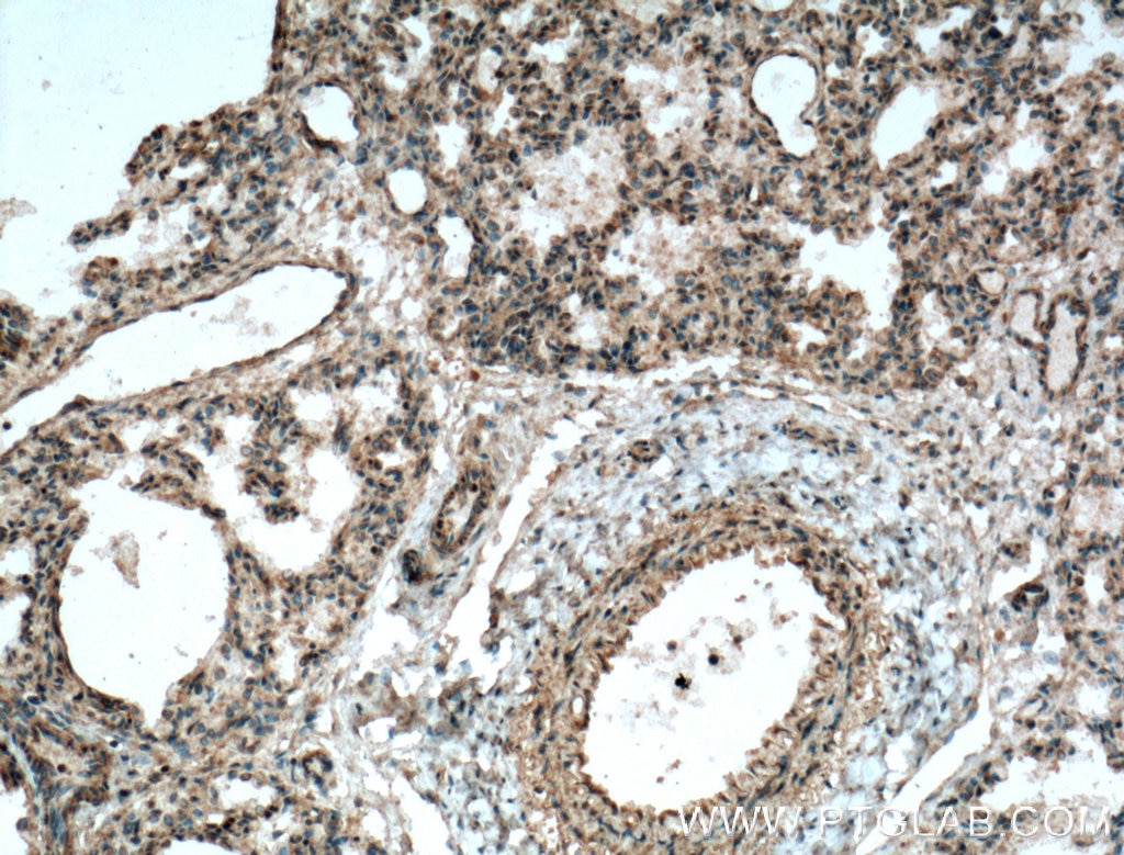IHC staining of human lung using 27308-1-AP