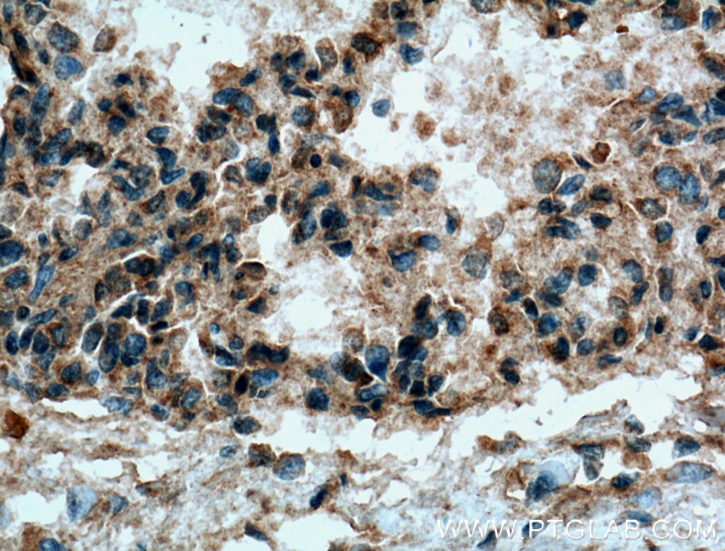 Immunohistochemistry (IHC) staining of human lung tissue using COX2/ Cyclooxygenase 2/ PTGS2 Polyclonal antibody (27308-1-AP)