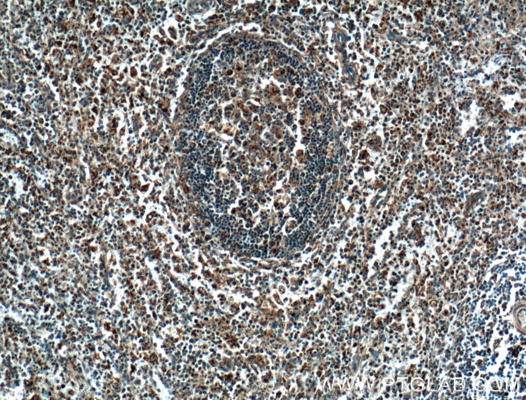 Immunohistochemistry (IHC) staining of human spleen tissue using COX2/ Cyclooxygenase 2/ PTGS2 Polyclonal antibody (27308-1-AP)