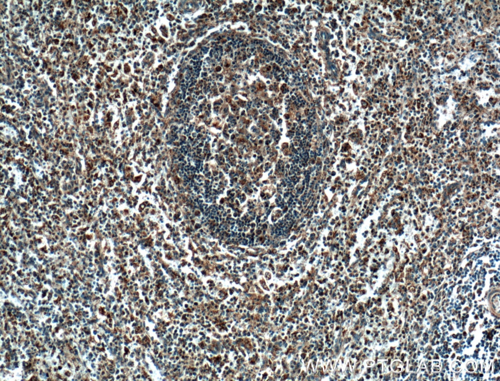 IHC staining of human spleen using 27308-1-AP