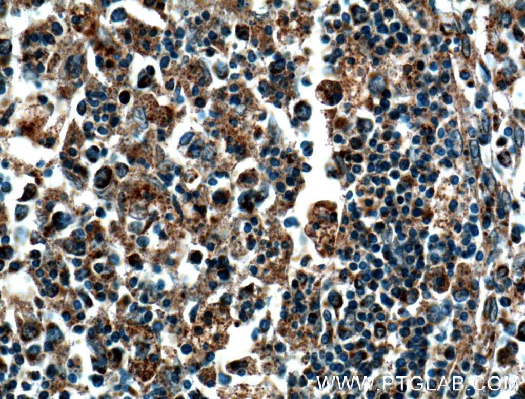 Immunohistochemistry (IHC) staining of human spleen tissue using COX2/ Cyclooxygenase 2/ PTGS2 Polyclonal antibody (27308-1-AP)