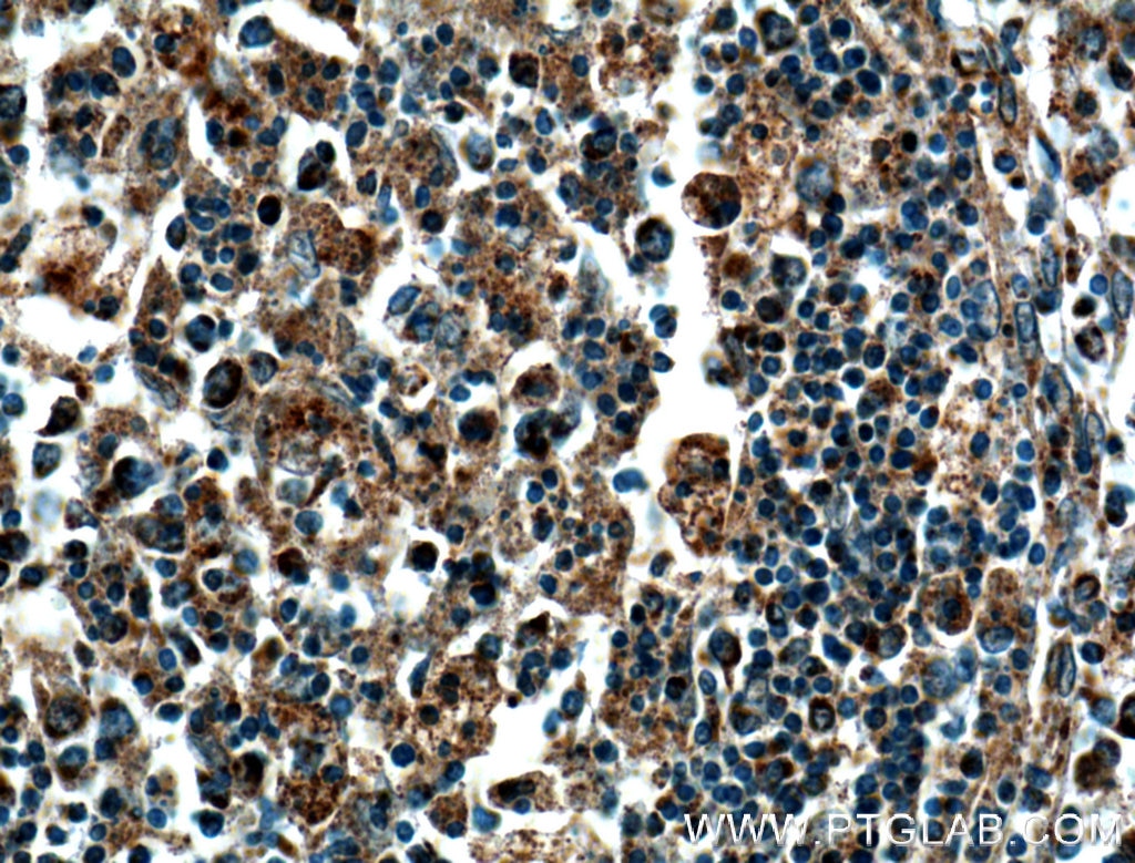 IHC staining of human spleen using 27308-1-AP