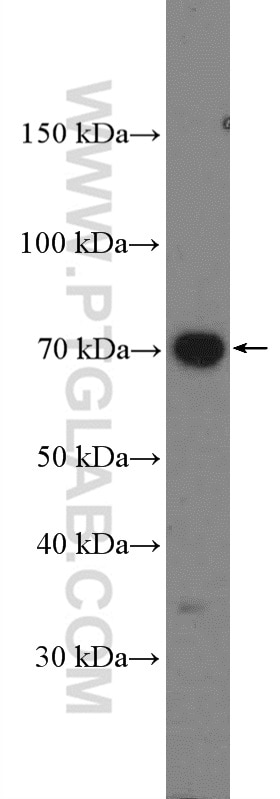 Western Blot (WB) analysis of A549 cells using COX2/ Cyclooxygenase 2/ PTGS2 Polyclonal antibody (27308-1-AP)