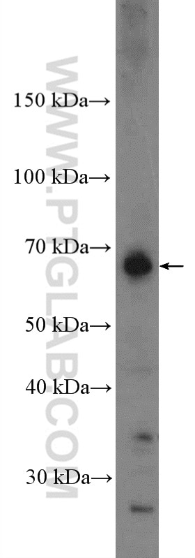 WB analysis of mouse lung using 27308-1-AP