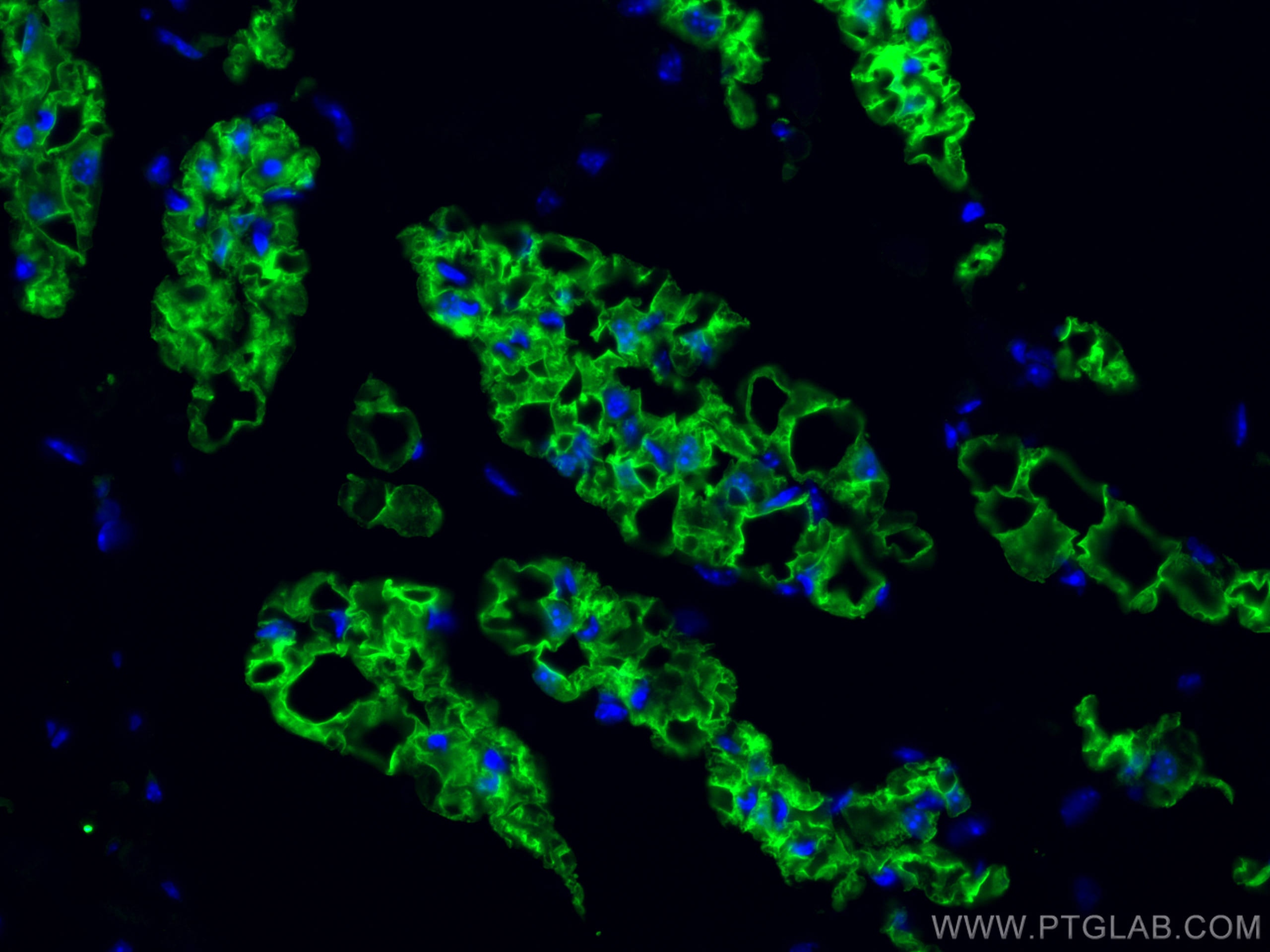Immunofluorescence (IF) / fluorescent staining of mouse lung tissue using COX2/ Cyclooxygenase 2/ PTGS2 Monoclonal antibody (66351-1-Ig)