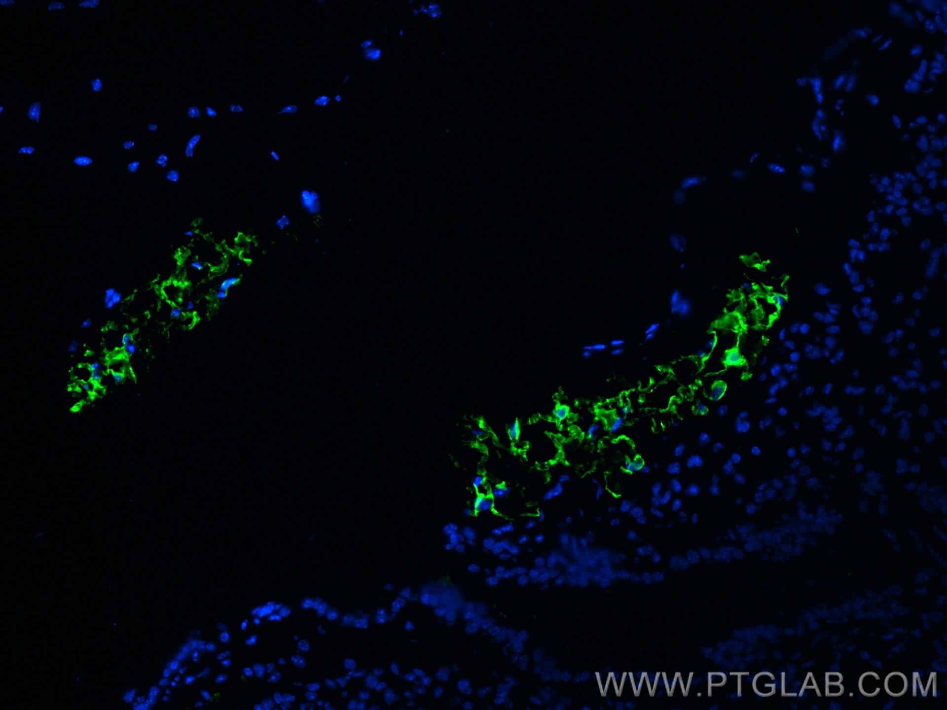 Immunofluorescence (IF) / fluorescent staining of mouse lung tissue using COX2/ Cyclooxygenase 2/ PTGS2 Monoclonal antibody (66351-1-Ig)