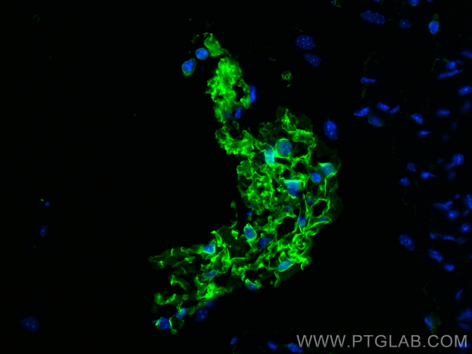 Immunofluorescence (IF) / fluorescent staining of mouse lung tissue using COX2/ Cyclooxygenase 2/ PTGS2 Monoclonal antibody (66351-1-Ig)