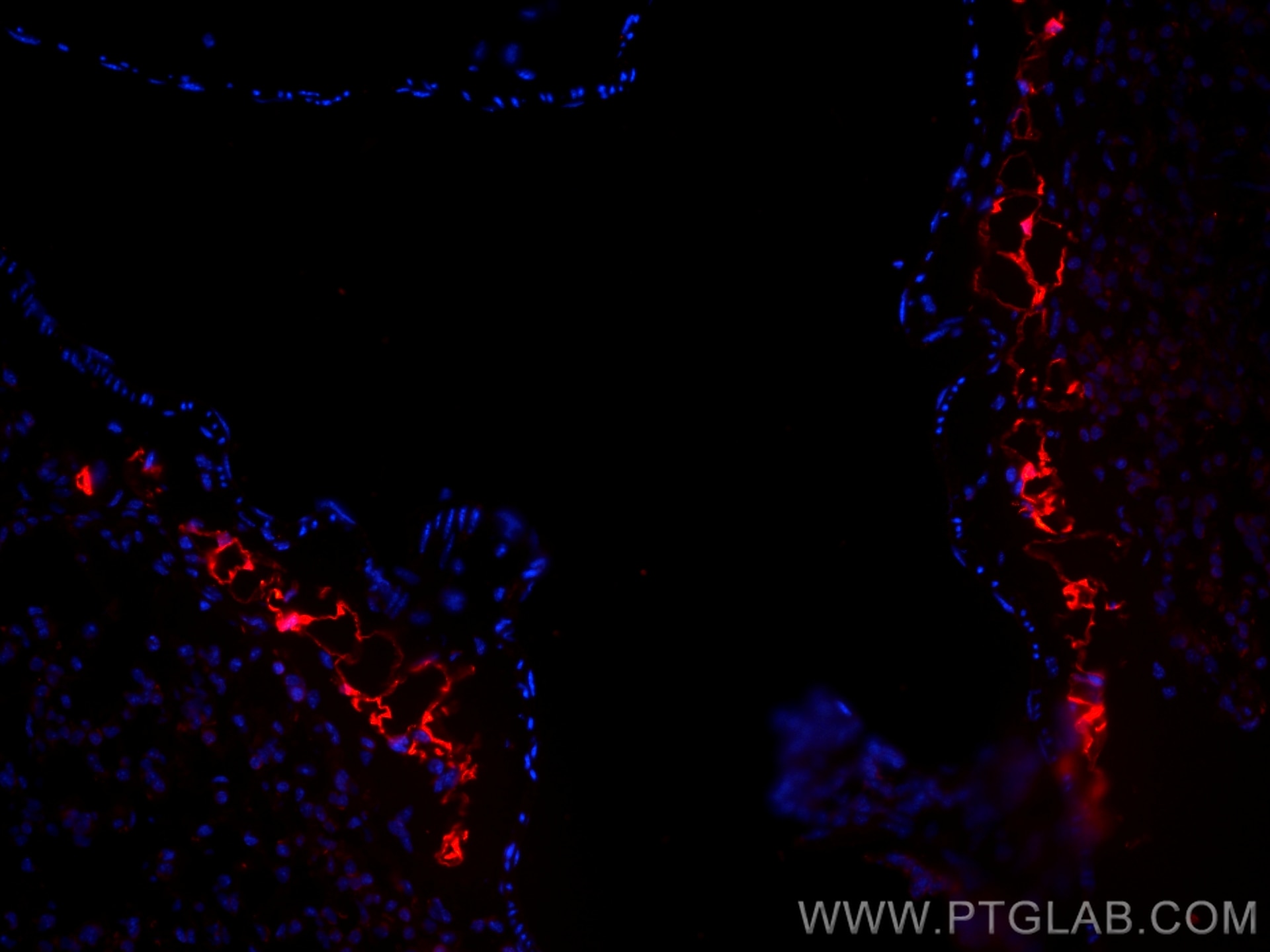 Immunofluorescence (IF) / fluorescent staining of mouse lung tissue using CoraLite®594-conjugated COX2/ Cyclooxygenase 2/ PT (CL594-66351)