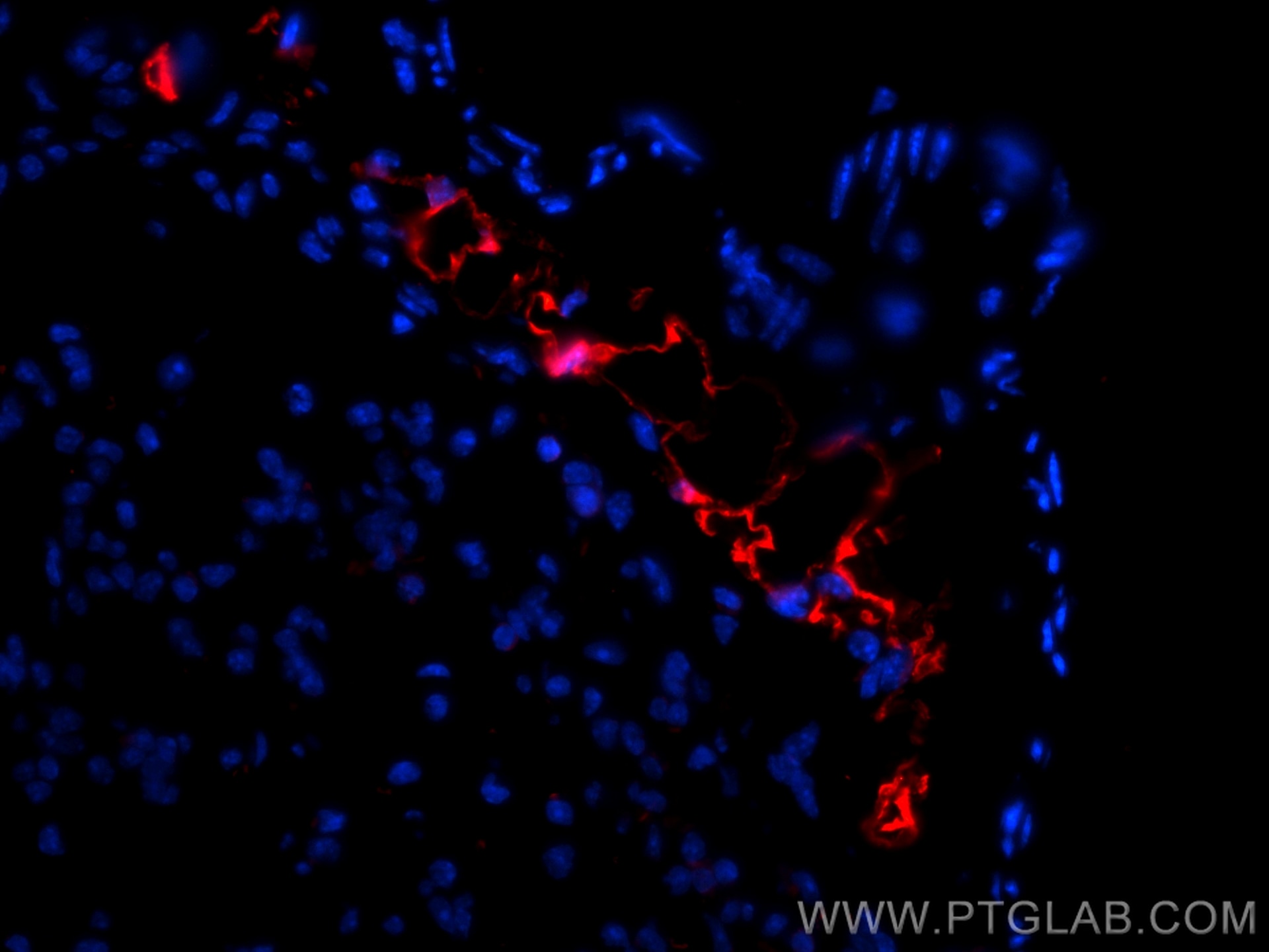 Immunofluorescence (IF) / fluorescent staining of mouse lung tissue using CoraLite®594-conjugated COX2/ Cyclooxygenase 2/ PT (CL594-66351)