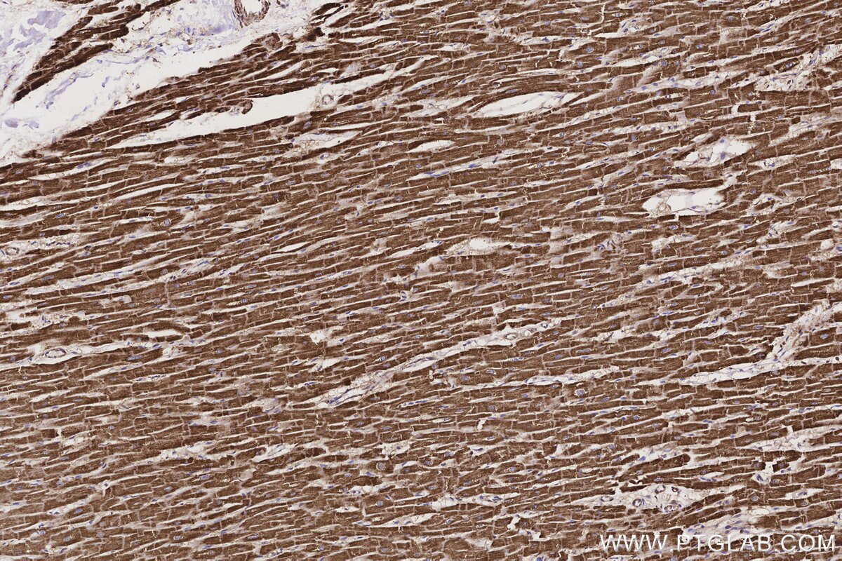 IHC staining of human heart using 84197-1-RR Immunohistochemistry (IHC) staining of human heart tissue using MTCO3 Recombinant monoclonal antibody (84197-1-RR)