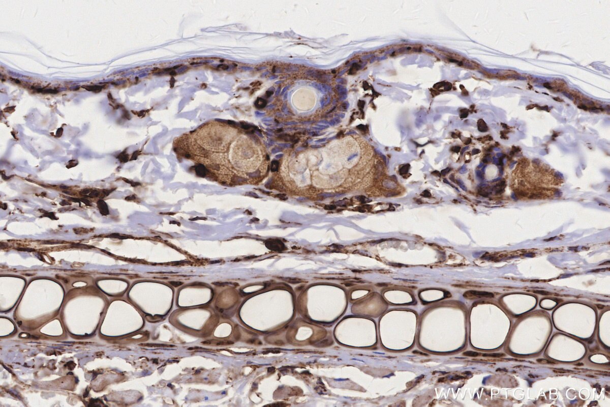 IHC staining of rat skin using 84197-1-RR Immunohistochemistry (IHC) staining of rat skin tissue using MTCO3 Recombinant monoclonal antibody (84197-1-RR)