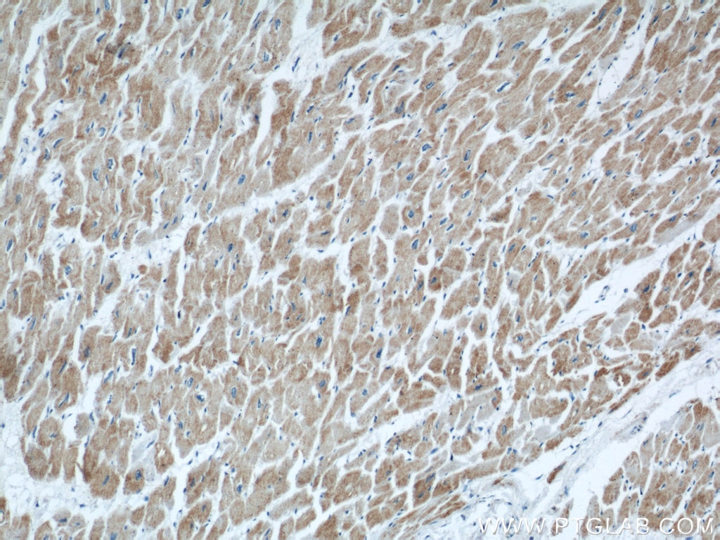 Immunohistochemistry (IHC) staining of human heart tissue using COXIV Polyclonal antibody (11242-1-AP)