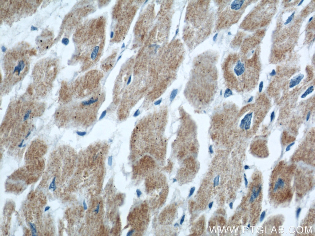 Immunohistochemistry (IHC) staining of human heart tissue using COXIV Polyclonal antibody (11242-1-AP)