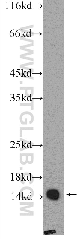 Western Blot (WB) analysis of rat brain tissue using COXIV Polyclonal antibody (11242-1-AP)