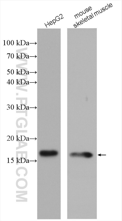 Western Blot (WB) analysis of various lysates using COXIV Polyclonal antibody (11242-1-AP)