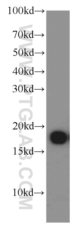 Western Blot (WB) analysis of A375 cells using COXIV Polyclonal antibody (11242-1-AP)
