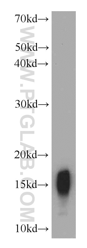Western Blot (WB) analysis of mouse skeletal muscle tissue using COXIV Polyclonal antibody (11242-1-AP)