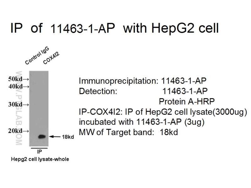 Immunoprecipitation (IP) experiment using COX4I2 Polyclonal antibody (11463-1-AP)