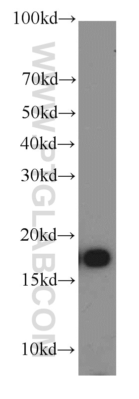 Western Blot (WB) analysis of A375 cells using COX4I2 Polyclonal antibody (11463-1-AP)