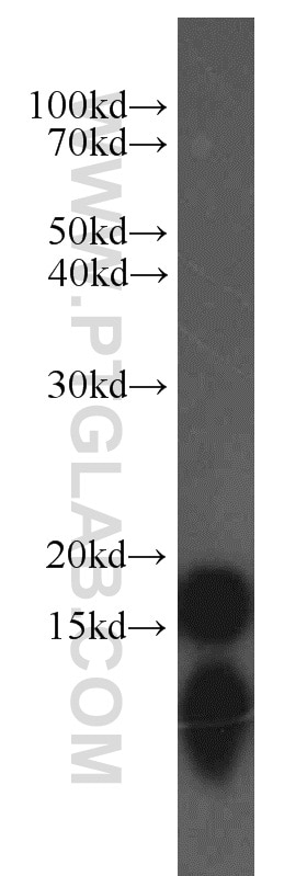 Western Blot (WB) analysis of human brain tissue using COX4I2 Polyclonal antibody (11463-1-AP)