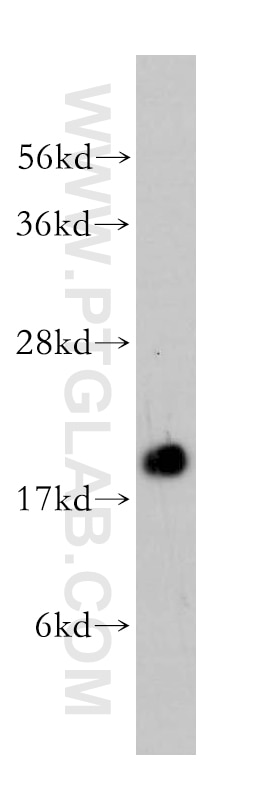 Western Blot (WB) analysis of human brain tissue using COX4I2 Polyclonal antibody (11463-1-AP)